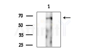 Phospho-RUNX2 (Ser275) Antibody - Western blot analysis of lysates from EC304 cellsserum starvation, using Phospho-RUNX2 (Ser275) Antibody at 1/1000 dilution.