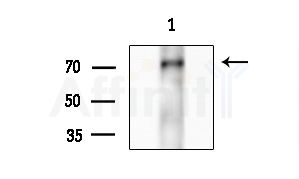 Phospho-RUNX2 (Ser275) Antibody - Western blot analysis of lysates from A375 cells(heat-shock treatment), using Phospho-RUNX2 (Ser275) Antibody at 1/1000 dilution.
