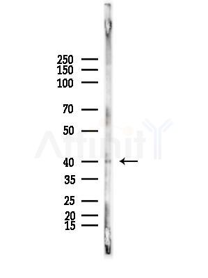 Phospho-CaMK1 alpha (Thr177) Antibody - Western blot analysis of lysates from B16F10-LUC cells(starvation,24h treatment), using Phospho-CaMK1 alpha (Thr177) Antibody at 1/1000 dilution.