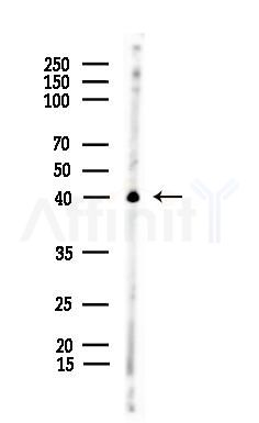 Phospho-p40 phox (Tyr243) Antibody - Western blot analysis of lysates from EC304 cells, using Phospho-p40 phox (Tyr243) Antibody at 1/1000 dilution.
