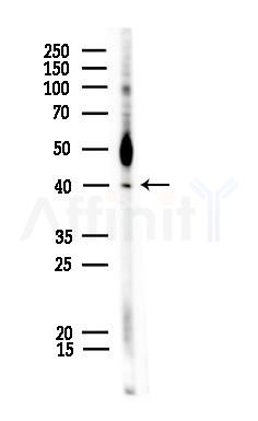 Phospho-p40 phox (Tyr243) Antibody - Western blot analysis of lysates from COLO205 cells, using Phospho-p40 phox (Tyr243) Antibody at 1/1000 dilution.