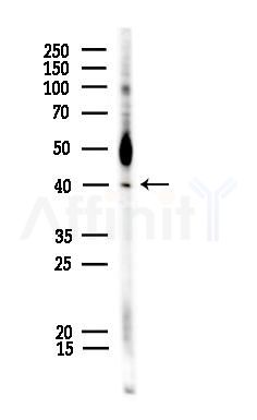 Phospho-p40 phox (Tyr243) Antibody - Western blot analysis of lysates from COLO205 cells, using Phospho-p40 phox (Tyr243) Antibody at 1/1000 dilution.