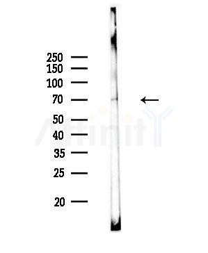 Phospho-SF1 (Ser80/Ser82) Antibody - Western blot analysis of lysates from Rat brain, using Phospho-SF1 (Ser80/Ser82) Antibody at 1/1000 dilution.
