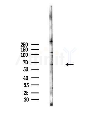 Phospho-SF1 (Ser80/Ser82) Antibody - Western blot analysis of lysates from A375 cells(starvation,24h treatment), using Phospho-SF1 (Ser80/Ser82) Antibody at 1/1000 dilution.