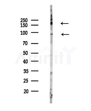 Phospho-TrkC (Tyr705) Antibody - Western blot analysis of lysates from HepG2 cells(LPS,4h treatment), using Phospho-TrkC (Tyr705) Antibody at 1/1000 dilution.