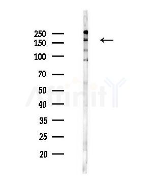 Phospho-TBC1D1 (Ser237) Antibody - Western blot analysis of lysates from HepG2 cells(LPS,4h treatment), using Phospho-TBC1D1 (Ser237) Antibody at 1/1000 dilution.