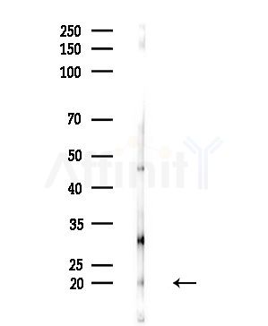 Phospho-FADD (Ser41) Antibody - Western blot analysis of lysates from EC304 cells(heat-shock,45min treatment), using Phospho-FADD (Ser41) Antibody at 1/1000 dilution.