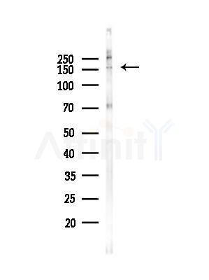 Phospho-BCL9L (Ser21 ) Antibody - Western blot analysis of lysates from B16F10-LUC cells(heat-shock,45min treatment), using Phospho-BCL9L (Ser21 ) Antibody at 1/1000 dilution.
