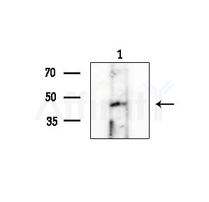 Phospho-MLKL (Ser125) Antibody - Western blot analysis of extracts from COLO205 cells, using Phospho-MLKL (Ser125) Antibody at 1/1000 dilution.