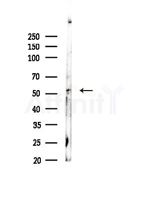 Phospho-MLKL (Ser125) Antibody - Western blot analysis of lysates from COLO205 cells, using Phospho-MLKL (Ser125) Antibody at 1/1000 dilution.