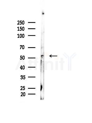 Phospho-MLKL (Ser125) Antibody - Western blot analysis of lysates from COLO205 cells, using Phospho-MLKL (Ser125) Antibody at 1/1000 dilution.