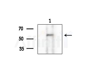 Phospho-MLKL (Ser358) Antibody - Western blot analysis of extracts from COLO205 cells, using Phospho-MLKL (Ser358) Antibody at 1/1000 dilution.