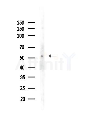 Phospho-MLKL (Ser358) Antibody - Western blot analysis of lysates from COLO205 cells, using Phospho-MLKL (Ser358) Antibody at 1/1000 dilution.