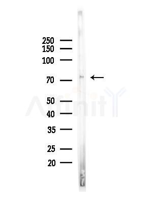 Phospho-SSH3 (Ser9) Antibody - Western blot analysis of lysates from COLO205 cells(UV,30min treatment), using Phospho-SSH3 (Ser9) Antibody at 1/1000 dilution.