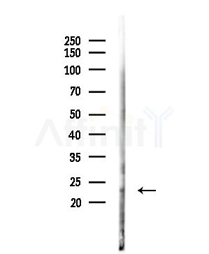 Phospho-BAD (Ser112)[Ser75] Antibody - Western blot analysis of lysates from Mouse liver, using Phospho-BAD (Ser112)[Ser75] Antibody at 1/1000 dilution.