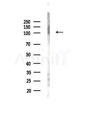 Phospho-REPS1 (Ser272) Antibody - Western blot analysis of lysates from HepG2 cells, using Phospho-REPS1 (Ser272) Antibody at 1/1000 dilution.