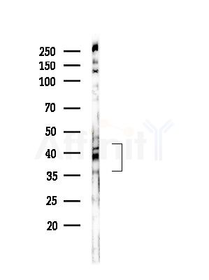 Phospho-PBK/TOPK (Ser59) Antibody - Western blot analysis of lysates from COLO205 cells, using Phospho-PBK/TOPK (Ser59) Antibody at 1/1000 dilution.