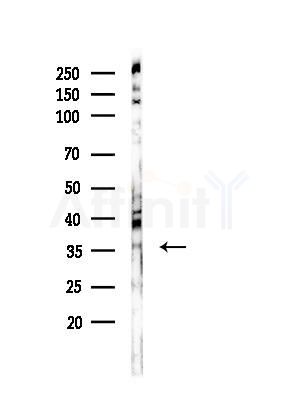 Phospho-PBK/TOPK (Ser59) Antibody - Western blot analysis of lysates from COLO205 cells, using Phospho-PBK/TOPK (Ser59) Antibody at 1/1000 dilution.
