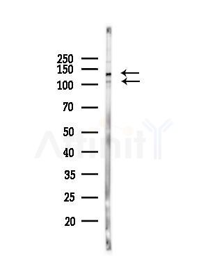 Phospho-NEDD4L (Ser479) Antibody - Western blot analysis of lysates from B16F10-LUC cells(heat-shock,45min treatment), using Phospho-NEDD4L (Ser479) Antibody at 1/1000 dilution.