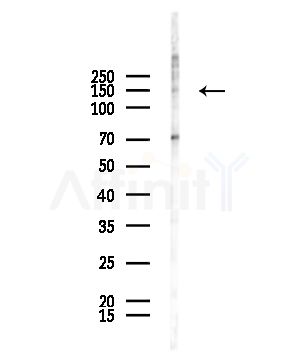 Phospho-LATS2 (Ser872) Antibody - Western blot analysis of lysates from B16F10-LUC cells(heat-shock,45min treatment), using Phospho-LATS2 (Ser872) Antibody at 1/1000 dilution.