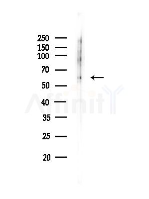 Phospho-RIP3 (Ser304 ) Antibody - Western blot analysis of lysates from COLO205 cells(heat-shock,45min treatment), using Phospho-RIP3/RIPK3 (Ser304 ) Antibody at 1/1000 dilution.