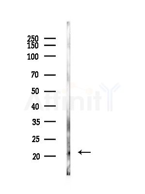 Phospho-Twist1 (Ser68) Antibody - Western blot analysis of lysates from B16F10-LUC cells(heat-shock, 45min treatment), using Phospho-Twist1 (Ser68) Antibody at 1/1000 dilution.