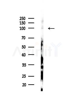Phospho-KIF5B (Ser154) Antibody - Western blot analysis of lysates from HepG2 cells, using Phospho-KIF5B (Ser154) Antibody at 1/1000 dilution.