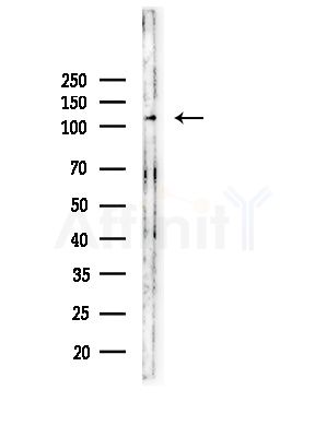 Phospho-Gli1 (Thr1074) Antibody - Western blot analysis of lysates from Rat testis, using Phospho-Gli1 (Thr1074) Antibody at 1/1000 dilution.