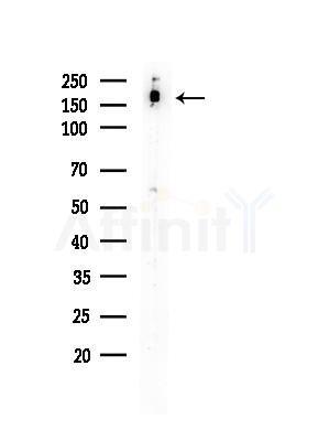 Phospho-Gli3 (Ser664) Antibody - Western blot analysis of lysates from COLO205 cells, using Phospho-Gli3 (Ser664) Antibody at 1/1000 dilution.