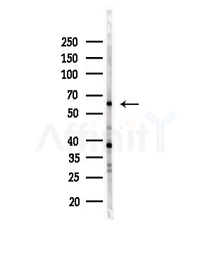 N-WASP Antibody - Western blot analysis of lysates from Mouse brain, using N-WASP Antibody at 1/1000 dilution.