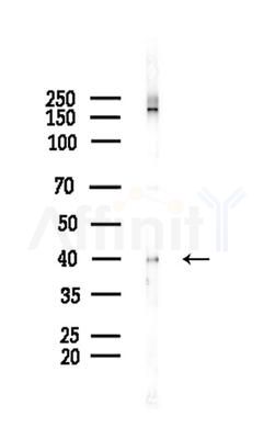 KMT5A Antibody - Western blot analysis of lysates from COLO205 cells(heat-shock,45min treatment), using KMT5A Antibody at 1/1000 dilution.
