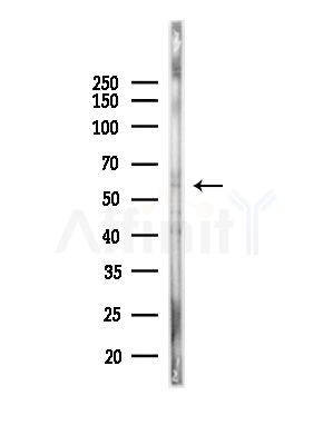 NEK2 Antibody - Western blot analysis of lysates from Mouse lung, using NEK2 Antibody at 1/1000 dilution.