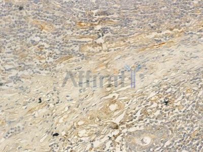 ABCB11 Antibody - AF7593 at 1/100 staining human normal tonsil tissue by IHC-P.