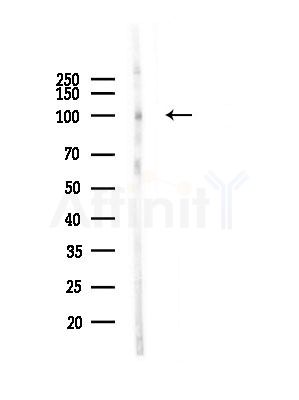 ARHGAP42 Antibody - Western blot analysis of lysates from A375 cells(LPS, 4h treatment), using ARHGAP42 Antibody at 1/1000 dilution.