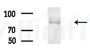 ARHGAP42 Antibody - Western blot analysis of extracts from COLO205 cells(heat-shock treatment), using ARHGAP42 Antibody at 1/1000 dilution.