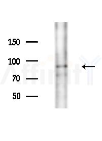 ARHGAP42 Antibody - Western blot analysis of extracts from HepG2 cells(starvation,24h treatment), using ARHGAP42 Antibody at 1/1000 dilution.