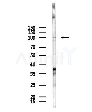 ARHGAP42 Antibody - Western blot analysis of lysates from HepG2 cells(starvation,24h treatment), using ARHGAP42 Antibody at 1/1000 dilution.