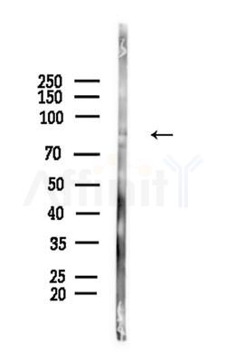 ARHGAP42 Antibody - Western blot analysis of lysates from COLO205 cells(heat-shock,45min treatment), using ARHGAP42 Antibody at 1/1000 dilution.