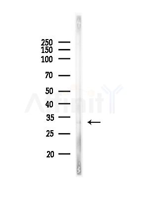 LAT Antibody - Western blot analysis of lysates from Rat liver, using LAT Antibody at 1/1000 dilution.