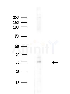 SGTA Antibody - Western blot analysis of lysates from A375 cells(heat-shock,45min treatment), using SGTA Antibody at 1/1000 dilution.