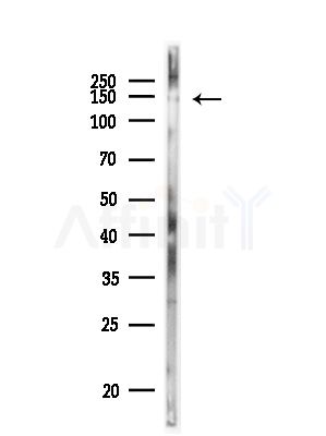 SF3B1 Antibody - Western blot analysis of lysates from MDA-MB-231 cells(heat-shock,45min treatment), using SF3B1 Antibody at 1/1000 dilution.
