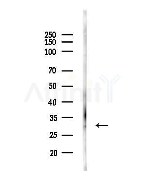 PZR Antibody - Western blot analysis of lysates from HUVEC cells(UV,30min treatment), using PZR Antibody at 1/1000 dilution.