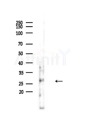 PZR Antibody - Western blot analysis of lysates from LoVo cells(heat-shock,45min treatment), using PZR Antibody at 1/1000 dilution.