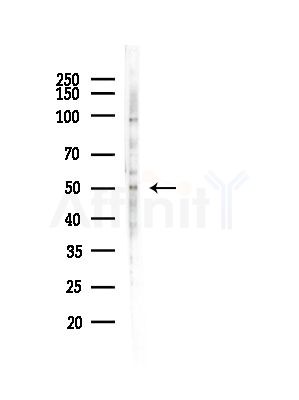OSR1 Antibody - Western blot analysis of lysates from A375 cells(LPS, 4h treatment), using OSR1 Antibody at 1/1000 dilution.