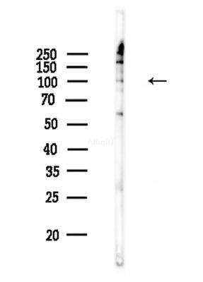 Retinoblastoma Antibody - Western blot analysis of lysates from COLO205 cells(heat-shock,45min treatment), using Retinoblastoma Antibody at 1/1000 dilution.