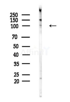 Retinoblastoma Antibody - Western blot analysis of lysates from Hela cells(LPS,4h treatment), using Retinoblastoma Antibody at 1/1000 dilution.