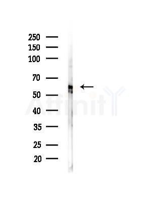 Hck Antibody - Western blot analysis of lysates from EC304 cells(heat-shock, 45min treatment), using Hck Antibody at 1/1000 dilution.