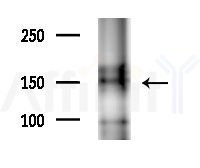 TBC1D1 Antibody - Western blot analysis of extracts from EC304 cells(heat-shock treatment), using TBC1D1 Antibody at 1/1000 dilution.