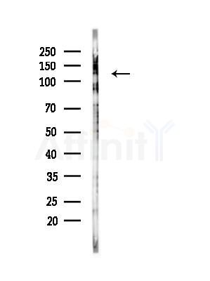 TBC1D1 Antibody - Western blot analysis of lysates from EC304 cells(heat-shock, 45min treatment), using TBC1D1 Antibody at 1/1000 dilution.