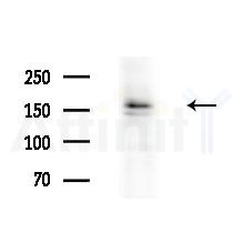 BCL9L Antibody - Western blot analysis of extracts from A375 cells(starvation,24h treatment), using BCL9L Antibody at 1/1000 dilution.